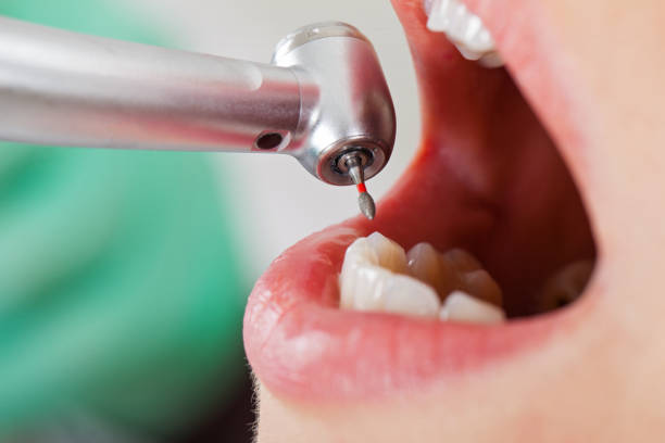 Best Emergency Dental Care for Trauma or Injury in Evanston, WY